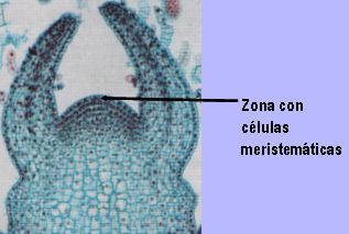 celula meristematica