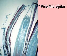 picomicropilar