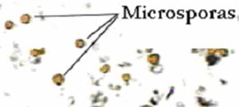 microspora